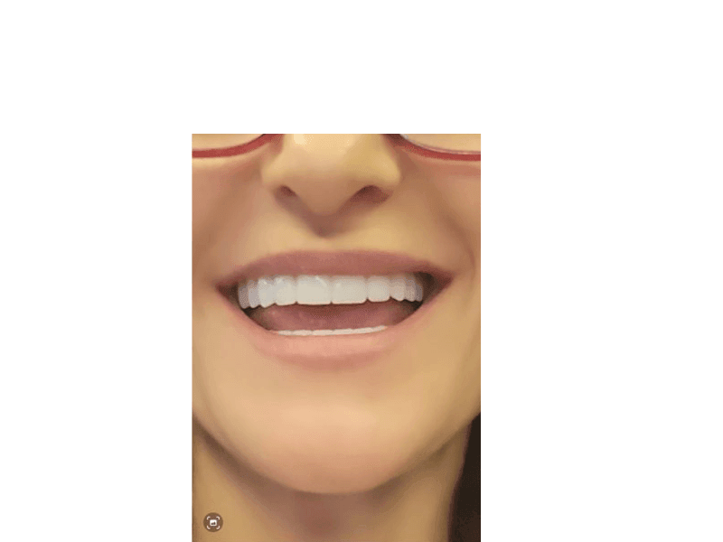 Close-up of a person smiling with white teeth and red-rimmed glasses.